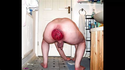 Gay Anal Rosebuds Pride Biggest Prolapsed Rosebuds Xhamster