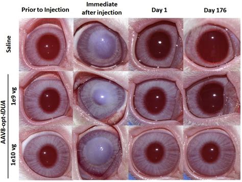 Ocular Tolerability And Immune Response To Corneal Intrastromal AAV