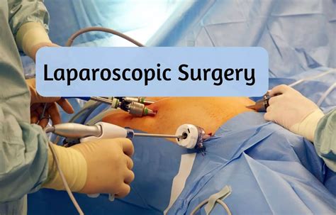 First 3d 4k Aided Laparoscopic Surgery Live Transmitted From Sir Ganga