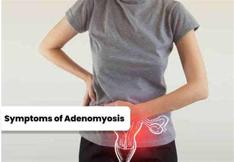 Understanding Adenomyosis Symptoms Treatment And Diagnosis Doctorsapp