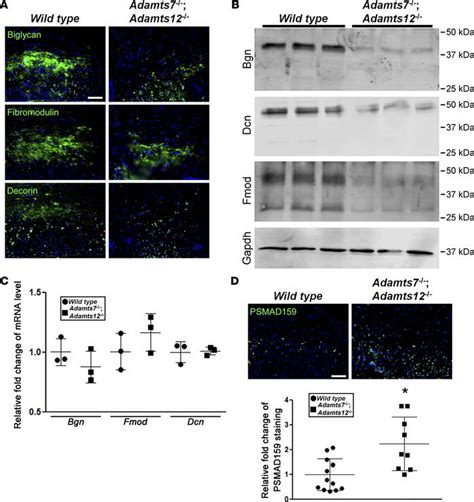 JCI Insight The Metalloproteinase Proteoglycans ADAMTS7 And ADAMTS12