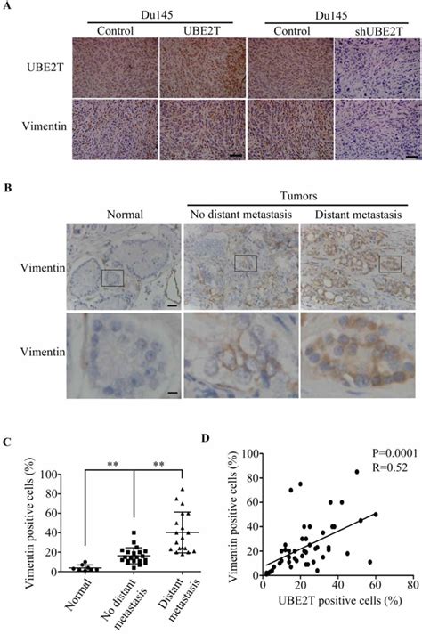 Elevated Expression Of Ube2t Exhibits Oncogenic Properties In Human Prostate Cancer Oncotarget