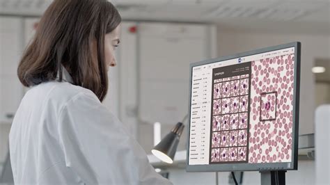 Can Labs Go Remote They Can With Digital Morphology Clinical Lab