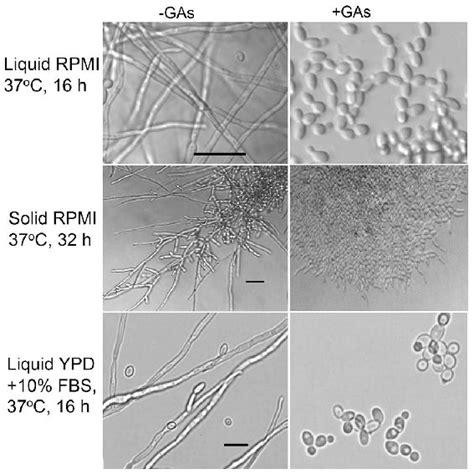 Gymnemic Acids Inhibit Hyphal Formation And Extension By C Albicans Download Scientific