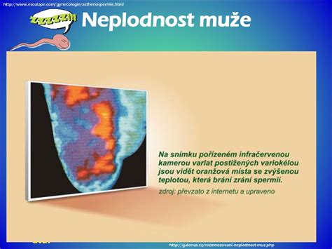 NEPLODNOST A ASISITOVANÁ REPRODUKCE - ppt stáhnout