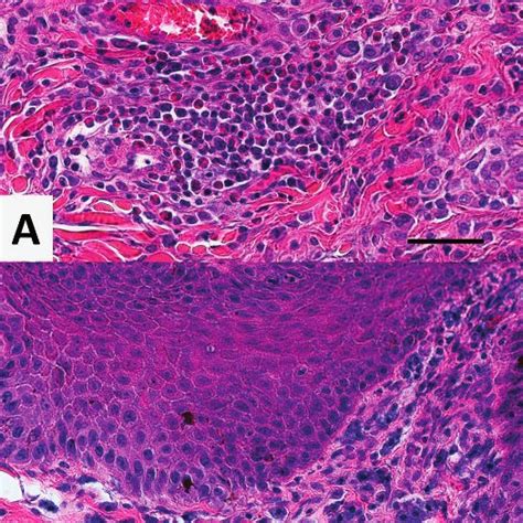 Macroscopic Skin Lesions In Red Foxes Vulpes Vulpes From Switzerland