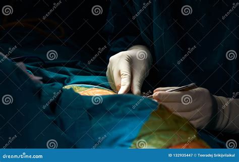 Surgeon Suturing The Wound In Operating Room Stock Image Image Of