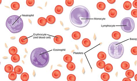 Chronic Eosinophilic Leukemia - StoryMD