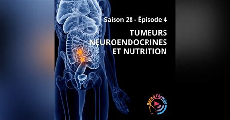 Tumeurs Neuroendocrines Et Nutrition Podcast Rare L Coute