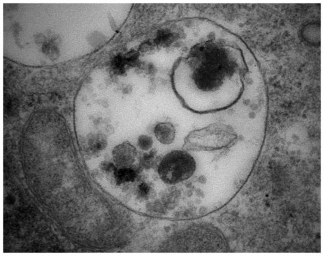 Vacuolar Atpase Mediated Intracellular Sequestration Of Ellipticine