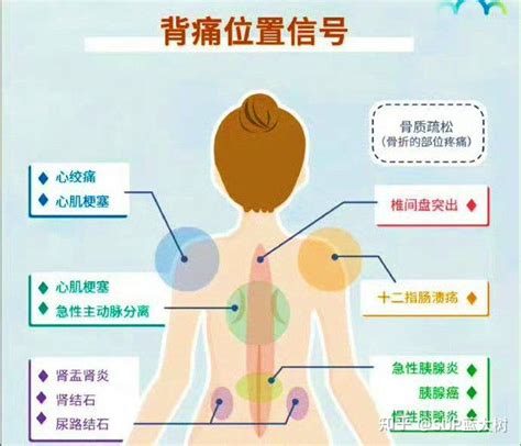 给你了背痛信号 你根本不知道 知乎