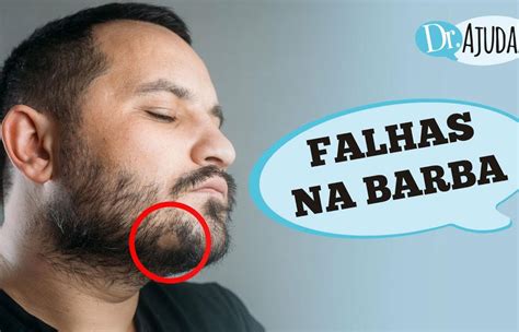 Falha Na Barba O Que Pode Ser - Quais as causas de falhas na barba? | Brasil 61