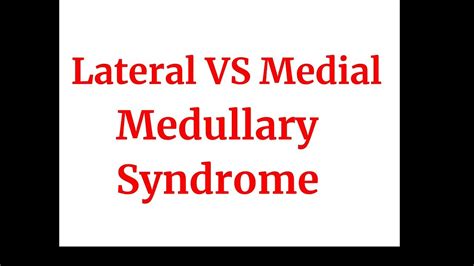 Lateral Vs Medial Anatomy