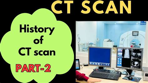 Part History Of Ct Scan By Prachi Radiology Computed