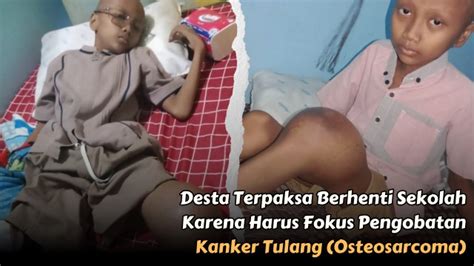 SharingHappiness Kanker Tulang Kaki Desta Terancam Diamputasi