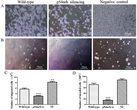 Knockdown of p54nrb inhibits migration invasion and TNF α release of