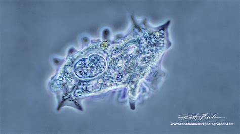 Amoeba Proteus Under A Microscope