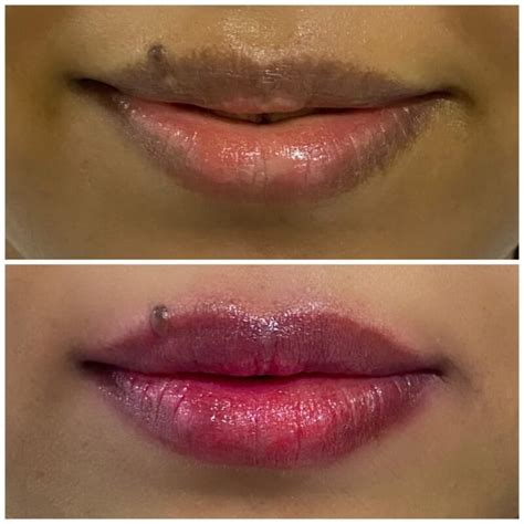 Lip micropigmentation – Face Spa by Sana Khan