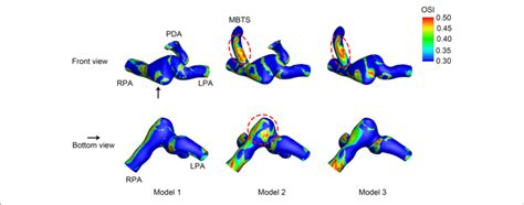 Oscillatory Shear Index Osi The Upper Row Is The Front View And