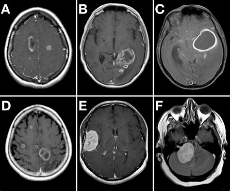 Image Radiopaedia Org