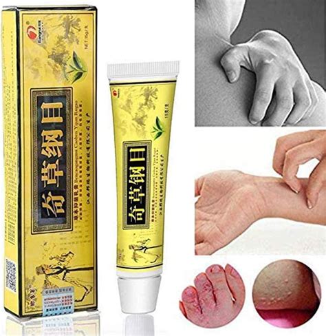 Pcs Chinese Herbal Eczema Psoriasis Creams For Dermatitis Pruritus