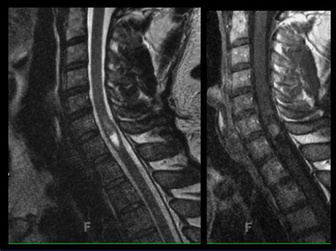 Question 16 MRI Online