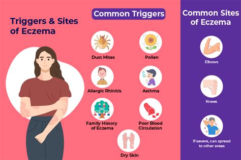 Skoop Issue 12 Eczema Myths And Treatments