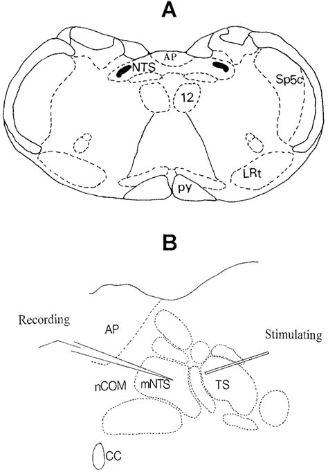 A Schematic Of A Transverse Section Of Medulla Oblongata At The Level