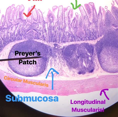 Ileum Histology