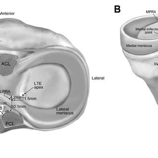 Pdf Qualitative And Quantitative Anatomic Analysis Of The Posterior