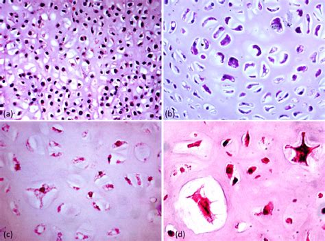 FIG URE 4 Histology of cartilage anlages shows densely packed smaller... | Download Scientific ...