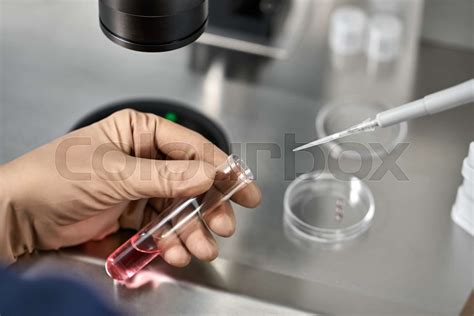 Process Of In Vitro Fertilization In Laboratory Stock Image Colourbox