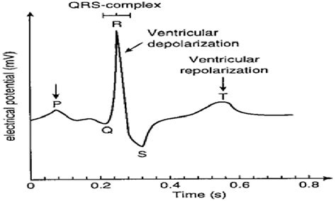 Ecg Diagram Labeled