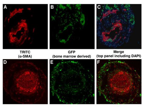 Gfp Positive Bone Marrow Derived Cells Incorporate Into The Vessel Wall