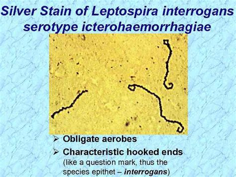 Spirochaetales Treponema Borrelia Leptospira Taxonomy