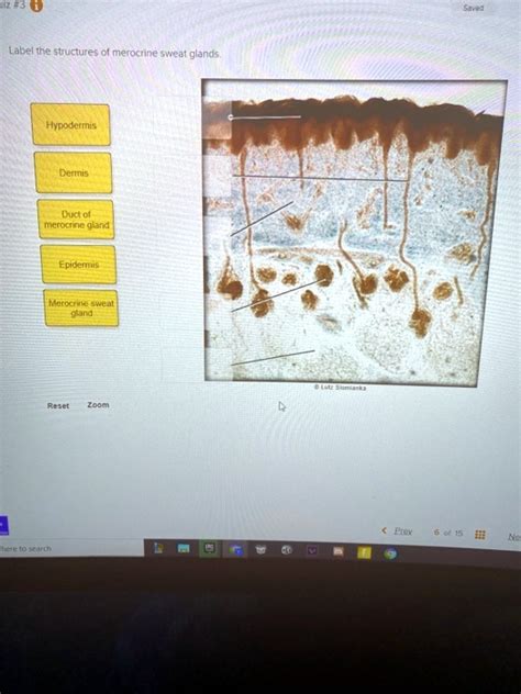 Solved Label The Structures Of Merocrine Sweat Glands Hypodermis