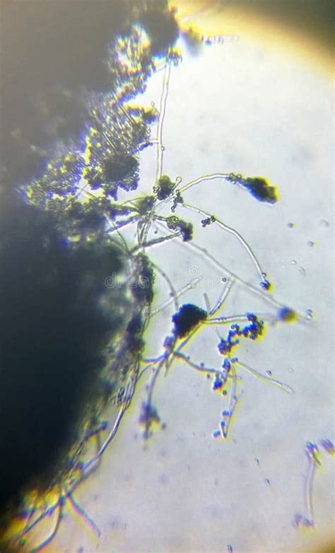 Penicillium Genus Moho Esporas Micelio Bajo Microscopio Foto De Archivo