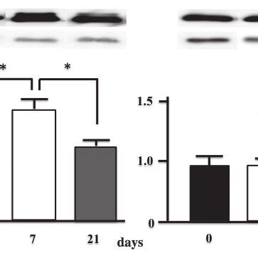 Western Blot Analysis Demonstrating The Expression Of Mnsod Protein In