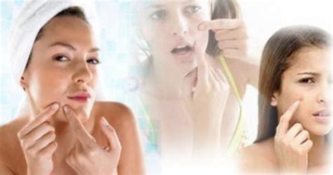 hormonal imbalances   adult acne essential health natural