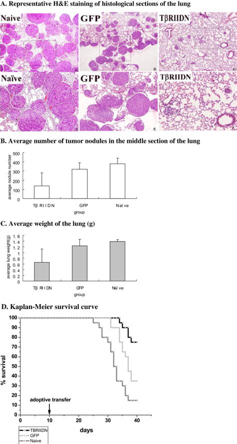 Adoptive Transfer of Tumor Reactive Transforming Growth Factor β