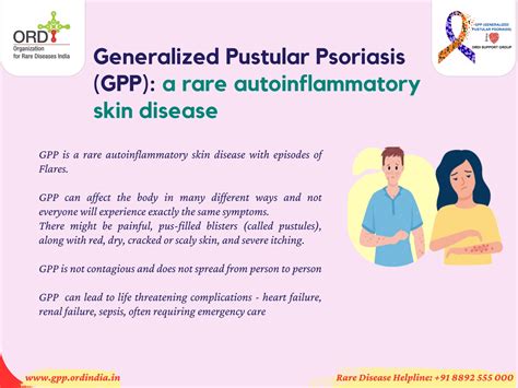 Patients Gpp Generalized Pustular Psoriasis