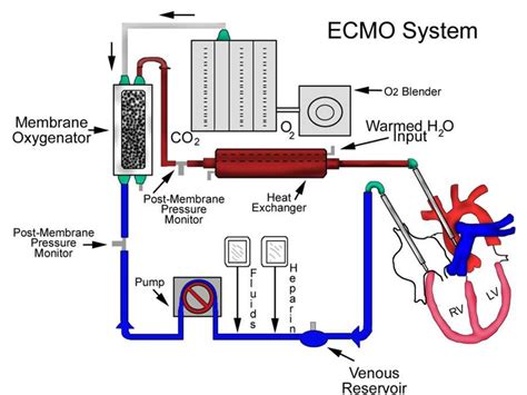 Экстракорпоральная мембранная оксигенация (ЭКМО, ЭМО, ECMO, ЭТМО ...