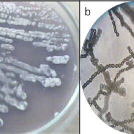 A LIGHT GREY COLONIES WITH DARK PURPLE DIFFUSIBLE PIGMENT OF S