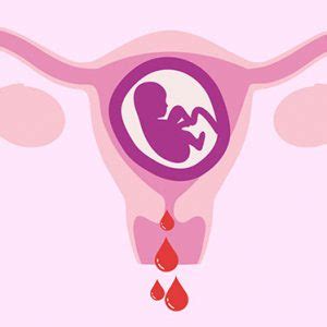 Gebelikte vaginal kanama görülmesi ne anlama gelir Acil Çözüm