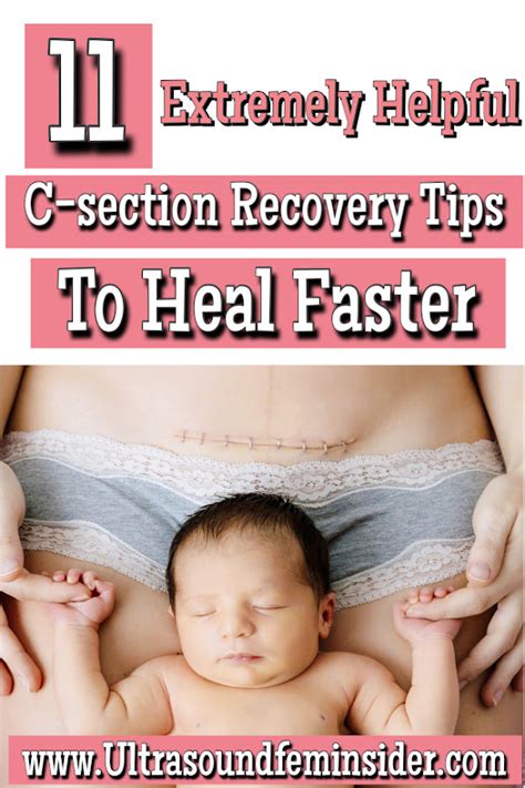 C Section Recovery Tips To Heal Faster Ultrasoundfeminsider