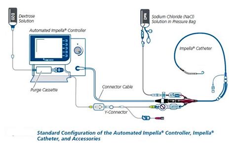 Impella ventricular assist device