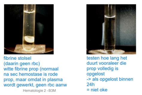 Hemato Lab Diagnostiek Secundaire Hemostase Tt Fibrinogeenbepaling