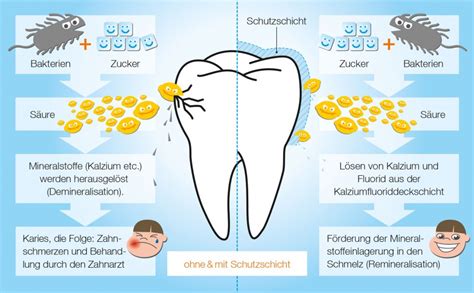 Härtung des Zahnschmelzes