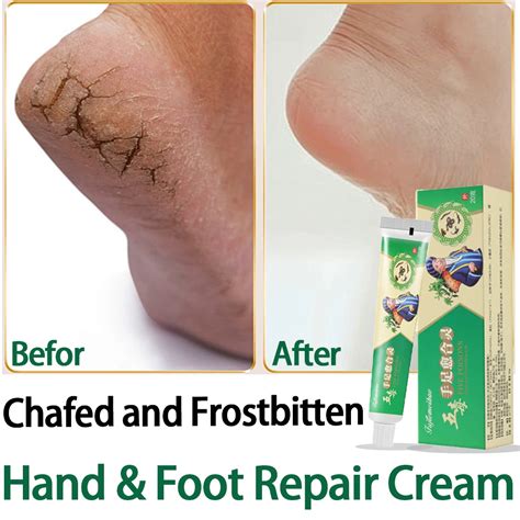 Herbal Frostbite Anti Crack Foot Cream Oil Anti Drying Crack Feet Cream Heel Cracked Repair