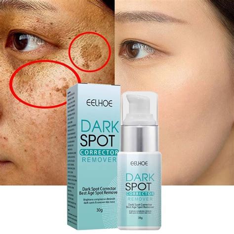 Dark Spot Corrector Remover Whitening Moisturizing Brighten Improving